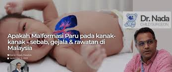 Tingkat kecacatan bisa sangat bervariasi. Merawat Kecacatan Bayi Di Malaysia Dr Nada Child Surgeon