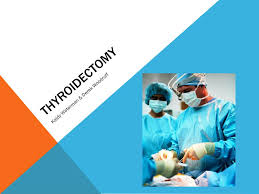 Low ferritin (the stored form of iron) is one of the most common causes of hair loss in women. Ppt Thyroidectomy Powerpoint Presentation Free Download Id 2285782