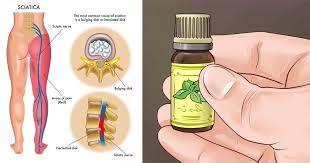 Essential oils contain concentrated plant extracts. Rub Pain Relieving Essential Oil Blends Directly On Your Sciatic Nerve For Immediate Pain Relief