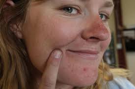 Winged Warnings: Poisoned