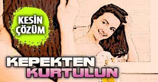 Kepek Nasil Gecer Sac Kepeginden Kurtulmanin 6 Dogal Yolu Sac Kepek Bakim Saglik Guzellik Kepek Dogal Saglik
