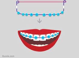Craft Wire Fake Braces Step 4 Diy Braces How To Make Braces Fake Braces