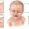 If you baby has a fever, let your doctor know, so that he is in the loop. Https Encrypted Tbn0 Gstatic Com Images Q Tbn And9gcrobkvfimtlzmfcrean6jdoiwlzddjw6nuyxl2og2aauxa2wiro Usqp Cau
