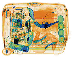 Why X Rays Are Called X Rays X Ray Xray Machine Screen Printing
