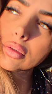 Unlocked🔓 the perfect pout👄- soft enhancement, big confidence.,  #LipFiller#LipFillerToronto, #PerfectPout#NaturalLipFiller,  #AestheticInjector