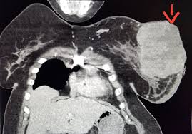 Pin By Eva On Radiology 2 Pet Ct Diagnostic Imaging Radiology