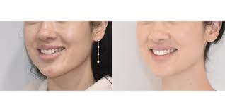 Amy K Hsu, MD, FACS, Board Certified Facial Plastic Surgeon