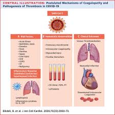Gregory rosic is a internist in rochester, nh. Covid 19 And Thrombotic Or Thromboembolic Disease Implications For Prevention Antithrombotic Therapy And Follow Up Jacc State Of The Art Review Journal Of The American College Of Cardiology