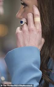 Why Does Kate Middleton Wear So Many Plasters