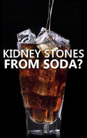 Dr Oz How To Prevent Kidney Stones Does Soda Cause Kidney Stones Kidney Stones What Causes Kidney Stones Kidney Stones Remedy