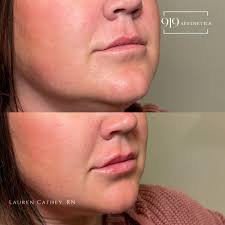 The Aesthetics Co. 931