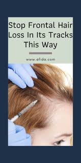 Thinning Hair And Bald Spots Are Remarkably Common In Females See The Development Causes As Well As Thera Frontal Hair Loss Problem Hair Loss Help Hair Loss