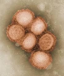 Check spelling or type a new query. File Cdc 11214 Swine Flu Jpg Wikimedia Commons