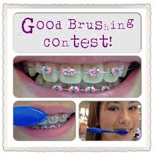 Pin By Hudson Orthodontics On Our Contests Orthodontics Marketing Orthodontic Contests Orthodontist Marketing