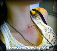 This Photo Is Of A Microdermal That Was Lost In Her Neck She Had An Infection And Chose To Remove The Top Herself To Clean It Microdermal Piercings Piercing