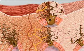 Level 1 tanning beds are the basic beds, with tanning times that are long but usually priced low. Sun Tanning Wikipedia