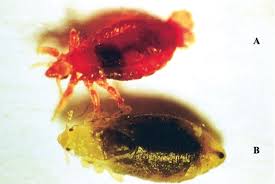 Image result for Typhus