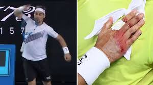 125,456 likes · 3,555 talking about this. Tennis News Fabio Fognin Smashes Racquet And Injures Hand During Australian Open Match With Jordan Thompson