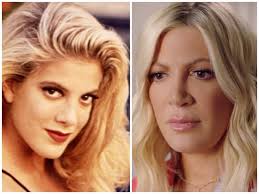 Tori spelling has had a trying few years. Beverly Hills 90210 Remake Dieses Facelifting Verdirbt Den Alten Zauber Radio Srf 3 Srf