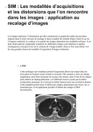 3éme année dts imagerie médicale. Recalage De Vertebres En Imagerie Medicales Miv