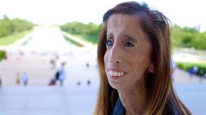 Lizzie Velasquez is beautiful and no 'monster