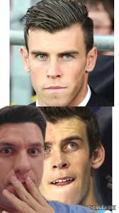 Orelha de abano realmente muda a aparência? Olha essa análise aqui do  jogador Gareth Bale.