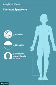 Image result for Localized Edema