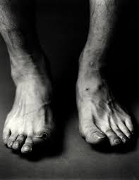 Contrary to expectations, e3 park won the game. ì‚°ì†Œíƒ±í¬ ì˜ ì•„ë¦„ë‹¤ìš´ ì™„ì „ì—°ì†Œ ê²½í–¥ì‹ ë¬¸