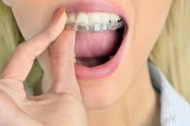 Check spelling or type a new query. Tips For Taking Care Of Your Invisalign Trays Linda K Westmoreland Dds Cosmetic General Dentistry