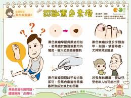 癌症保障怎麼選 重疾險 癌症險罹癌理賠大不同 comics peanuts comics