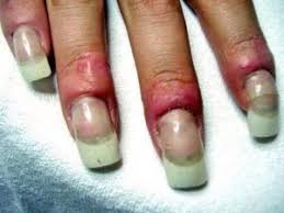 Well you're in luck, because here they come. Top 6 Problems With Acrylic Nails And How To Remedy Them Deenterprises