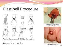Ppt Circumcision And The Foreskin Powerpoint Presentation Free Download Id 2237259