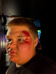 Did the preppy kid wear his helmet in the car or just to fight?