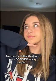 Long Nose No Jawline