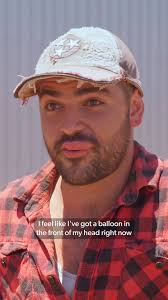 Jimmy's lips swell up after getting stung by a bee 🗣️: 'You look like one  of those Kardashians!' 🤣 , Season 2 of #OpalHuntersRedDirtRoadTrip airs