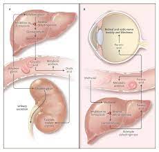 Fomepizole For Ethylene Glycol And Methanol Poisoning Nejm