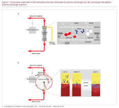Centrifugal And Membrane Therapeutic Plasma Exchange A