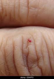 Image result for Trombicula autumnalis bites