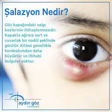 salazyon nedir goz ozel aydin goz hastanesi facebook