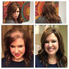 Hair Toppers For Women With Thinning Hair Or Hair Loss How To Get Instant Volume To Creat A B Thin Hair Styles For Women Thick Hair Styles Thick Hair Remedies