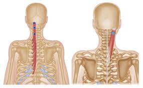 Trigger Point Therapy Neck Arthritis Cervical Spondylosis Cervical Spondylosis Neck Arthritis Trigger Points