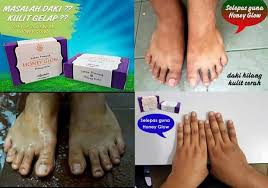 A wide variety of honey glow soap options are available to you, such as glycerine, olive oil, and green tea. Kelebihan Honey Glow Whitening Soap Pemutih Hilang Daki Facebook