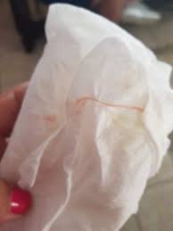 Hilitos De Sangre Cuando Me Limpio Club De Bebes Noviembre 2020 Babycenter