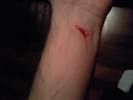 Self Harm Real Cut Mark On Hand