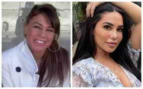 L'âge moyen de la chirurgie était de 25 mois avec une durée moyenne de suivi de 3,17 ans. Avant Apres Ces Stars De La Tele Realite Se Sont Metamorphosees Grace A La Chirurgie Esthetique