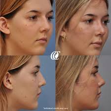 At OC Facial Plastic Surgery, we want to help patients