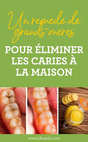 Remede De Grand Mere Pour Eliminer La Carie Dentaire A La Maison Esprit Sante Caries Carrie Dentaire Sante Bucco Dentaire