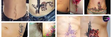 See more ideas about scar cover up tattoos to cover scars and cover tattoo. Scar Cover Up Tattoos That Will Amaze You All For Fashion Design
