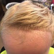 Thyroid disease and autoimmune thyroiditis. Girl Gives Brothers Back To School Haircuts Popsugar Family