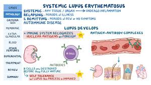 Indirectly, lupus can lead to cardiovascular problems. Systemic Lupus Erythematosus Sle Pathology Review Osmosis